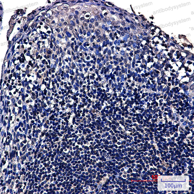 Anti-NOP10 Antibody (R2R52)