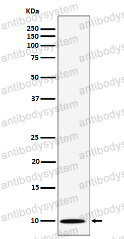 Anti-NOP10 Antibody (R2R51)