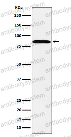 Anti-PPM1E Antibody (R2R53)