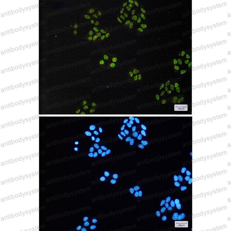 Anti-TAF15 Antibody (R2R55)