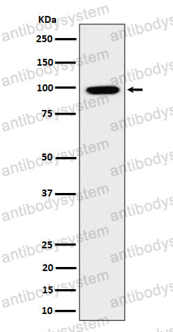 Anti-ARHGAP26 Antibody (R2R56)