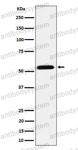 Anti-ENPP5 Antibody (R2R57)