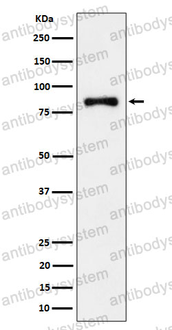 Anti-ALDH16A1 Antibody (R2R59)