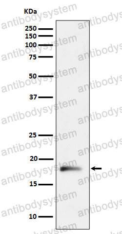 Anti-RPL26L1 Antibody (R2R60)