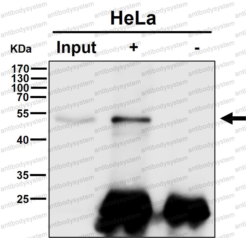 Anti-ABRAXAS1 Antibody (R2R61)