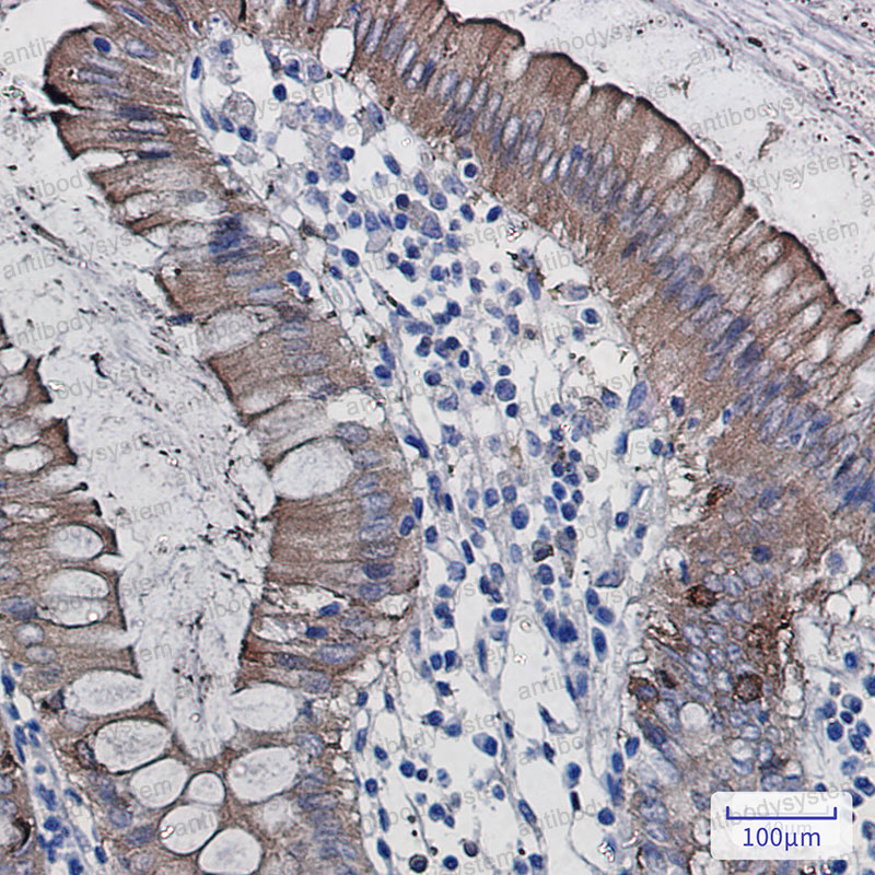 Anti-SCIN Antibody (R2R65)