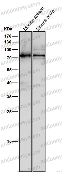 Anti-SCIN Antibody (R2R64)
