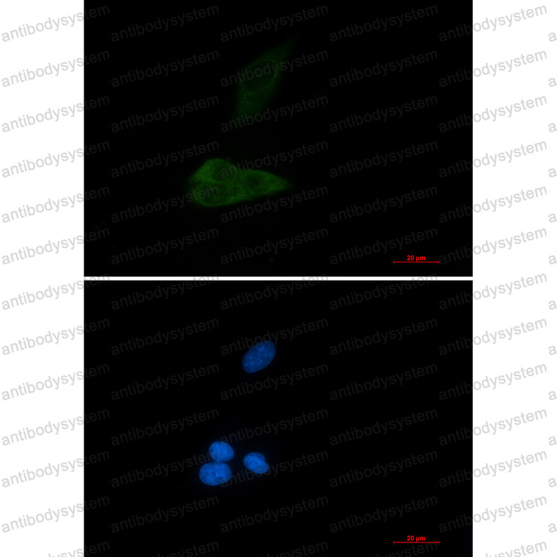 Anti-MAP3K4 Antibody (R2R67)