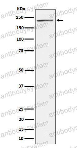 Anti-MAP3K4 Antibody (R2R66)