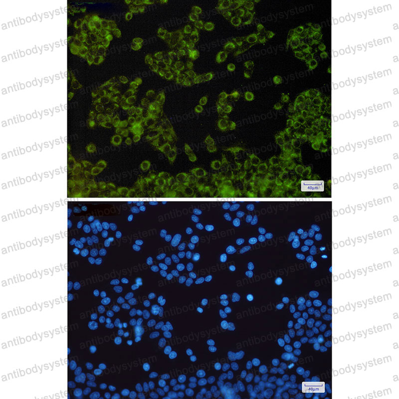 Anti-NDUFB9 Antibody (R2R69)