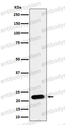 Anti-NDUFB9 Antibody (R2R68)