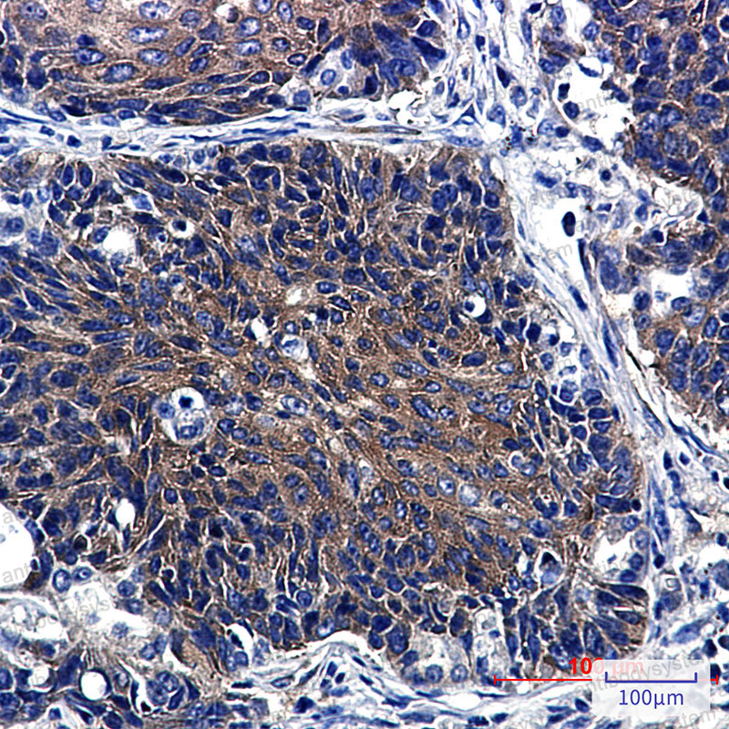 Anti-P4HTM Antibody (R2R71)