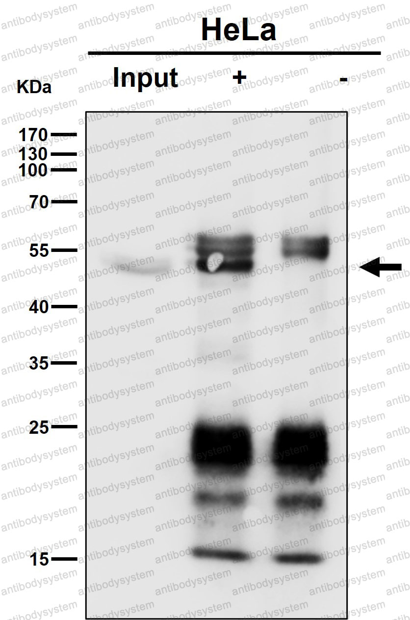 Anti-P4HTM Antibody (R2R70)