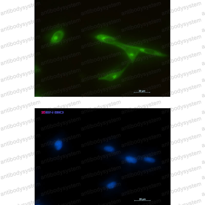 Anti-FRAT1 Antibody (R2R73)