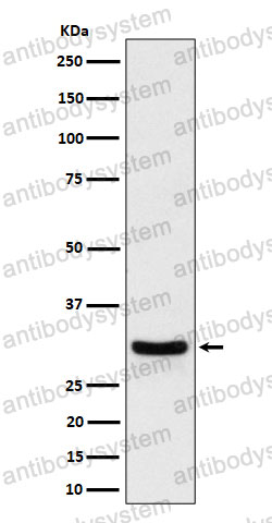 Anti-FRAT1 Antibody (R2R72)