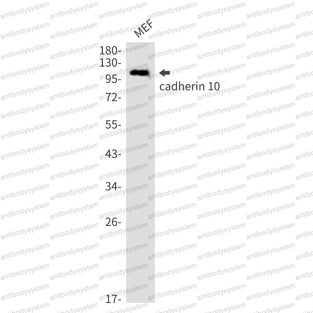 Anti-CDH10 Antibody (R2R75)