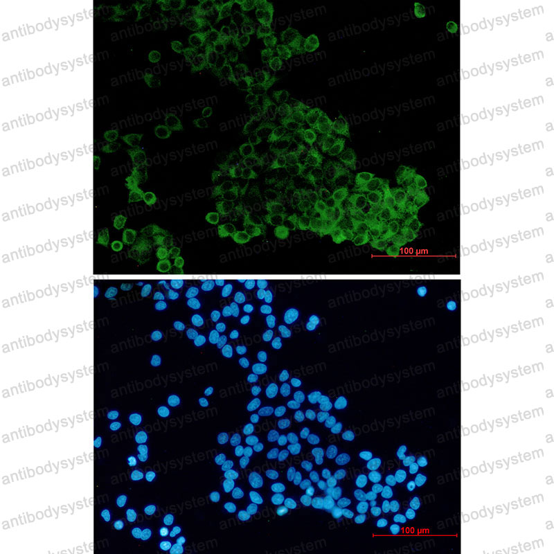 Anti-MADD Antibody (R2R77)
