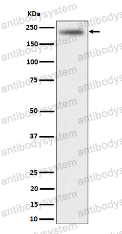 Anti-MADD Antibody (R2R76)