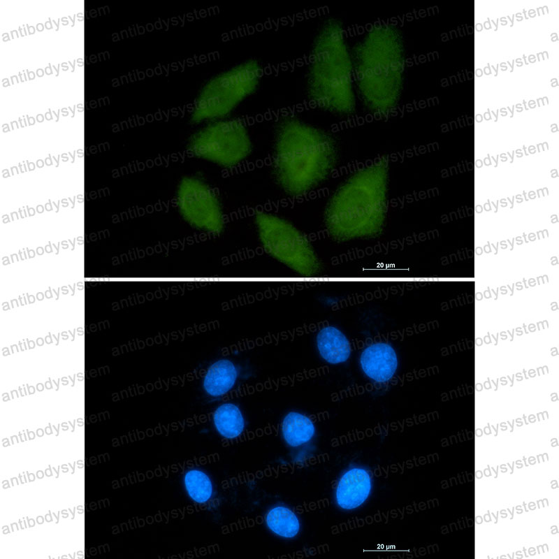 Anti-IPO9 Antibody (R2R79)