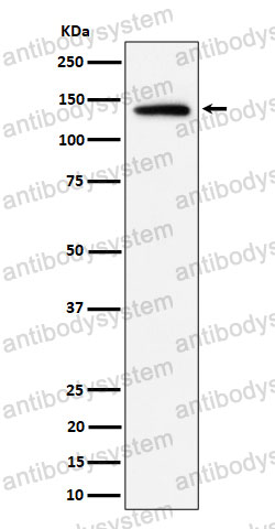Anti-IPO9/RANBP9 Antibody (R2R78)