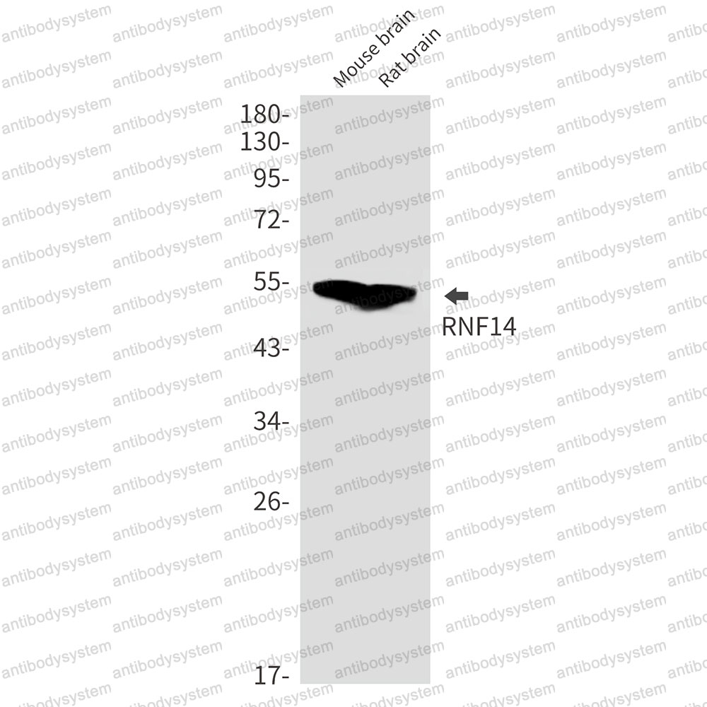 Anti-RNF14 Antibody (R2R85)