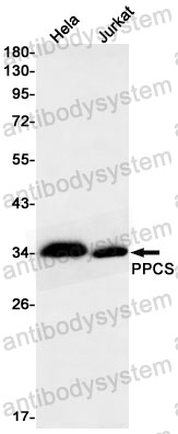 Anti-PPCS Antibody (R2R91)
