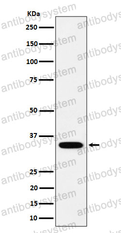 Anti-PPCS Antibody (R2R90)