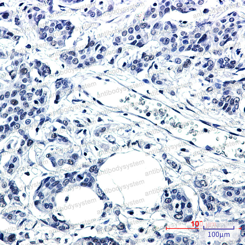 Anti-PNKP Antibody (R2R95)