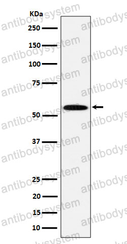 Anti-PNKP Antibody (R2R94)