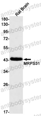Anti-MRPS31 Antibody (R2R99)