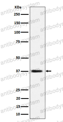 Anti-MRPS31 Antibody (R2R98)