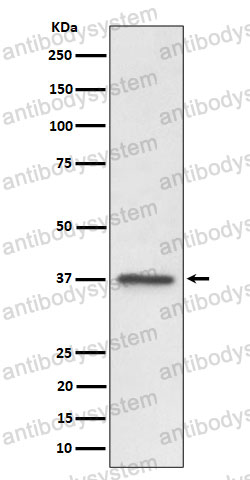 Anti-C3orf38 Antibody (R2S01)