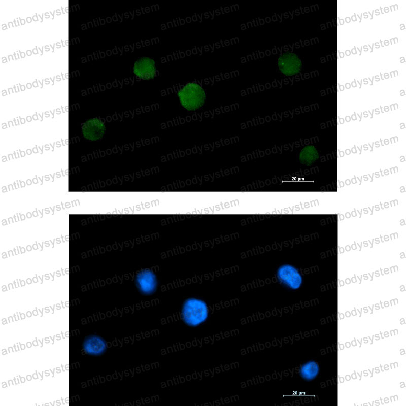 Anti-RAVER2 Antibody (R2S06)