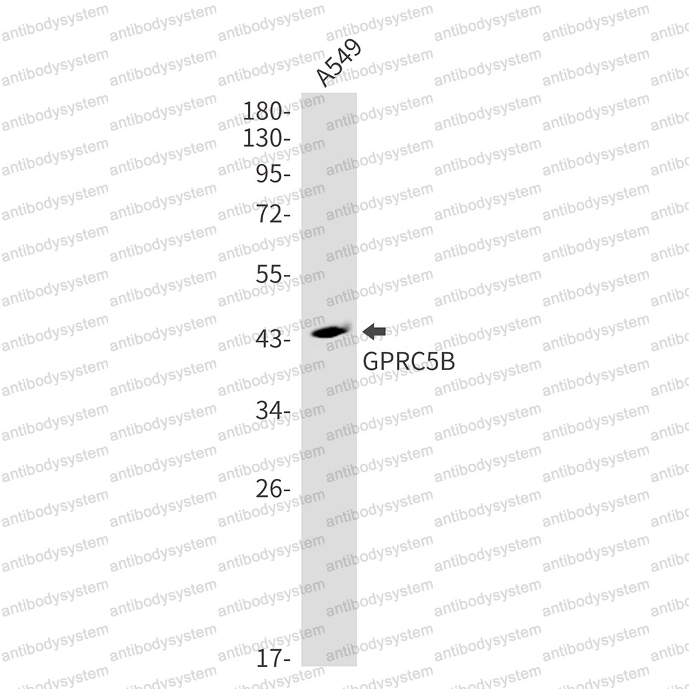 Anti-GPRC5B Antibody (R2S08)