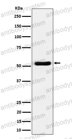 Anti-GPRC5B Antibody (R2S07)