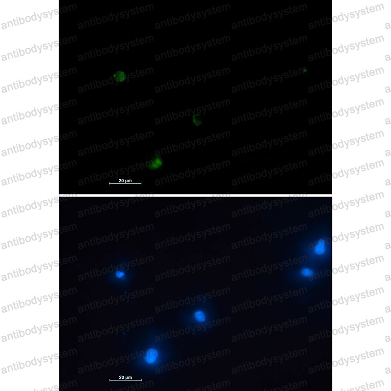 Anti-NUDT19 Antibody (R2S12)