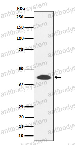 Anti-NUDT19 Antibody (R2S11)