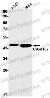 Anti-TOR4A Antibody (R2S14)