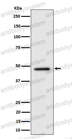 Anti-TOR4A Antibody (R2S13)