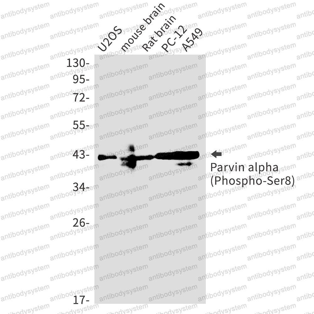 Anti-Phospho-PARVA/Parvin alpha (Ser8) Antibody (R2S15)
