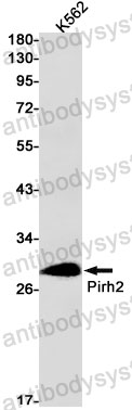Anti-RCHY1 Antibody (R2S16)