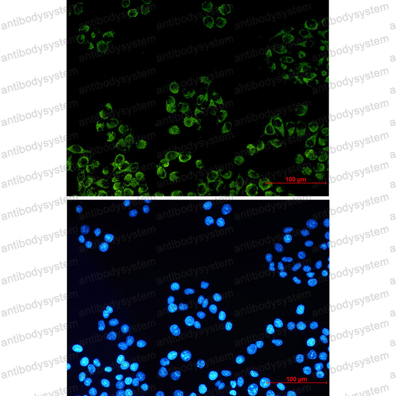 Anti-TSPO Antibody (R2S17)