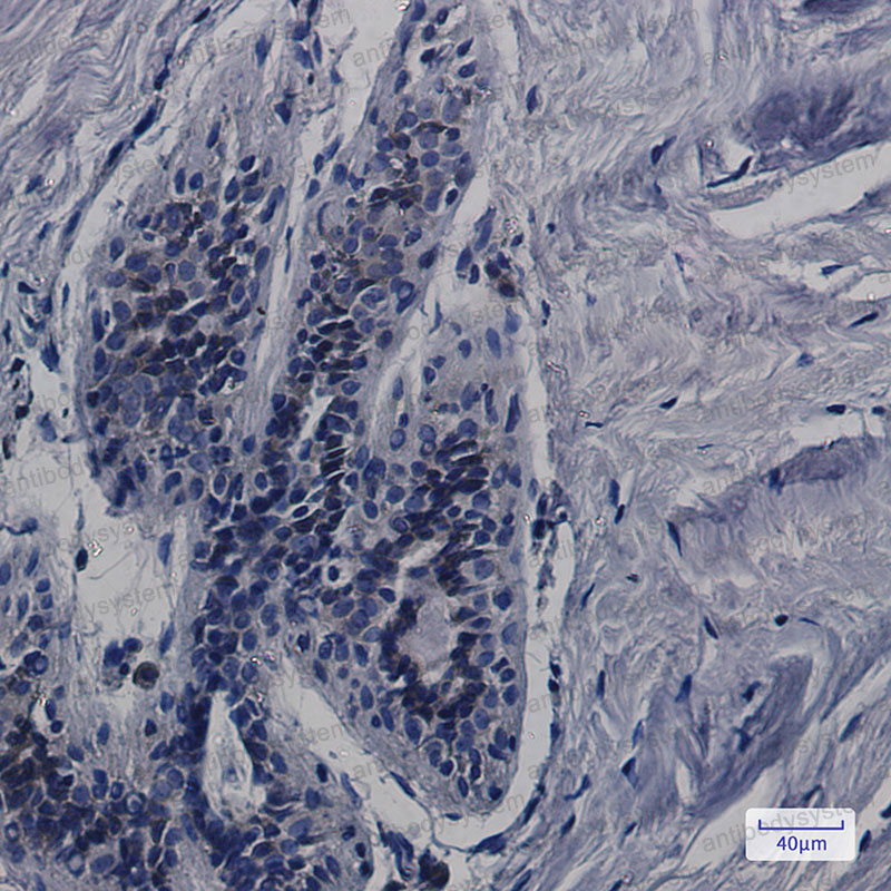 Anti-CDK5RAP3 Antibody (R2S18)