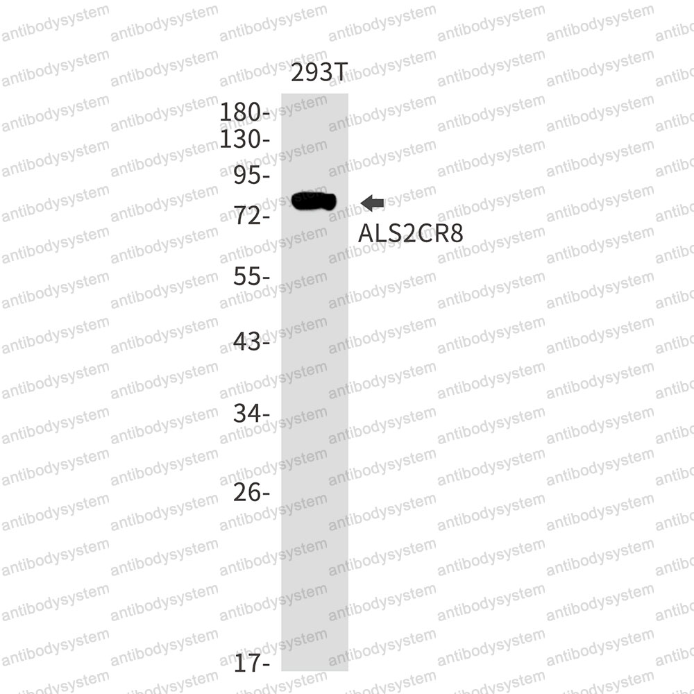 Anti-CARF Antibody (R2S20)