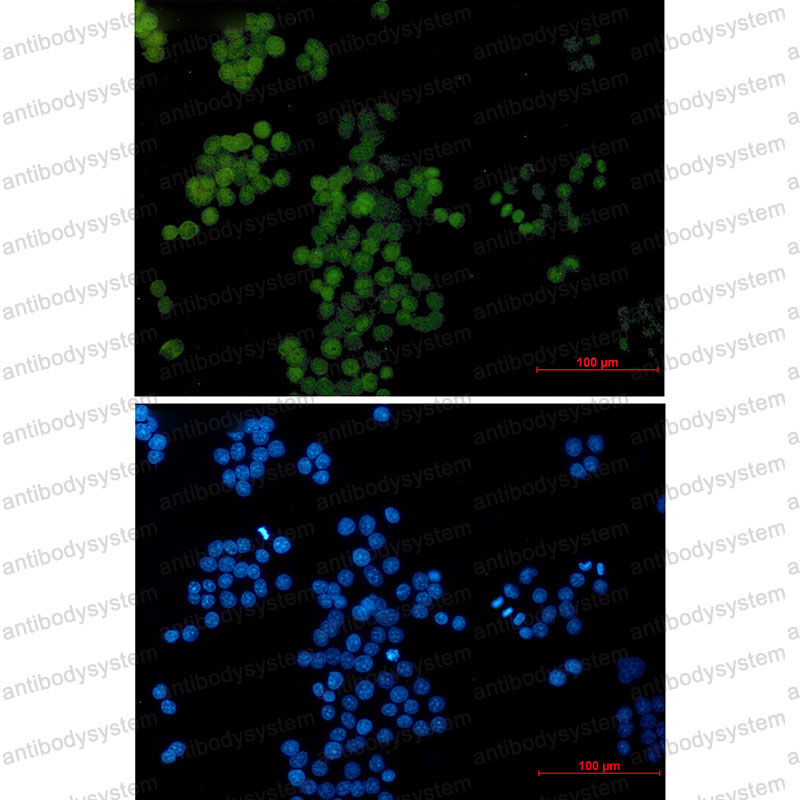 Anti-TFAP2C Antibody (R2S22)