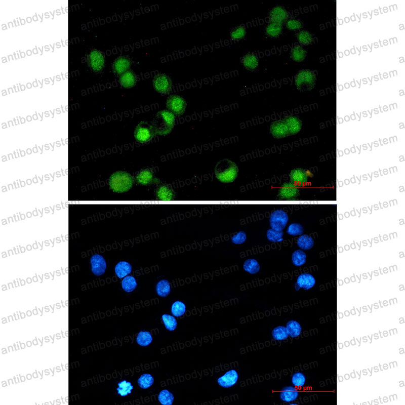Anti-TFAP2C Antibody (R2S21)