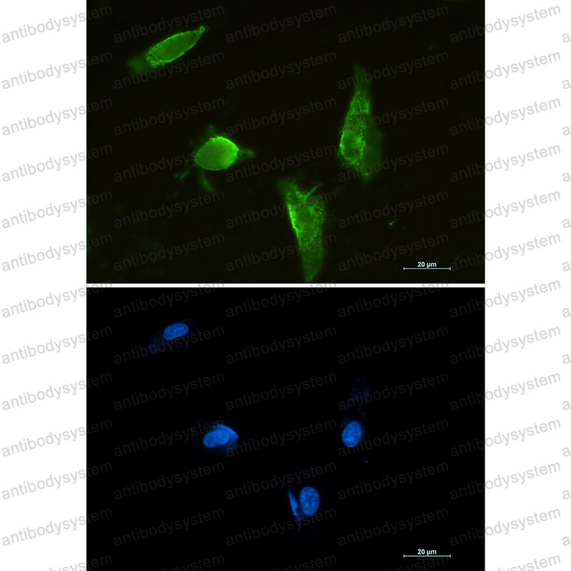 Anti-APTX Antibody (R2S23)