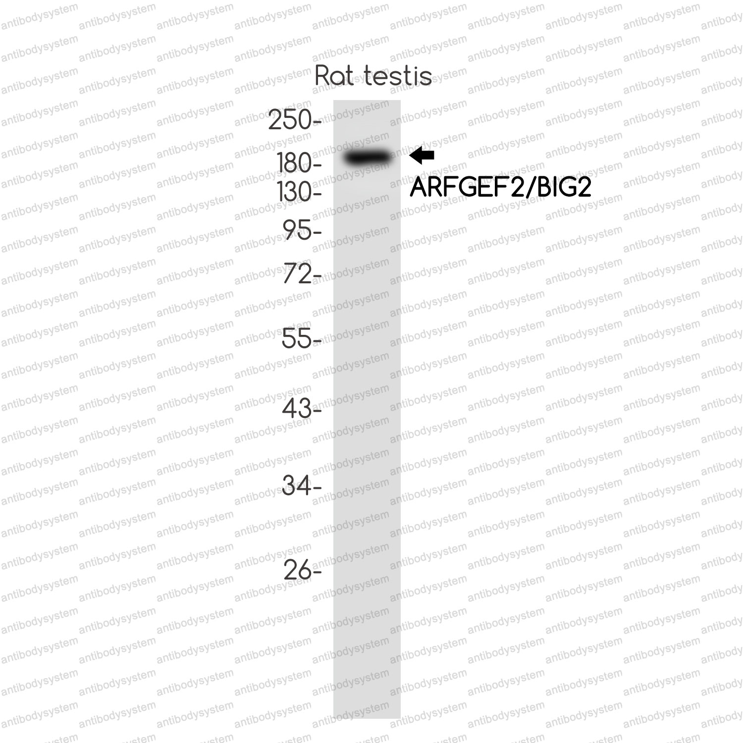 Anti-ARFGEF2 Antibody (R2S24)
