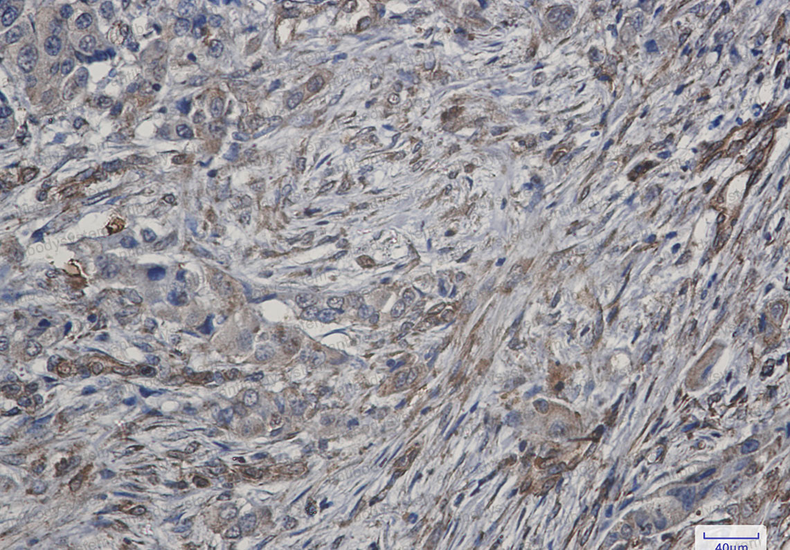 Anti-ATG4C Antibody (R2S25)