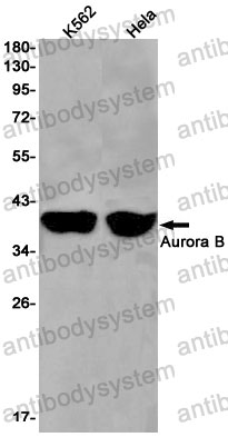 Anti-AURKB Antibody (R2S26)